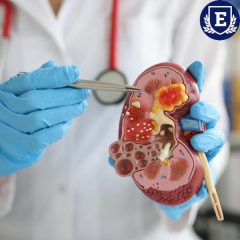 ATENCIÓN ESPECIALIZADA EN PACIENTES CON ENFERMEDAD RENAL