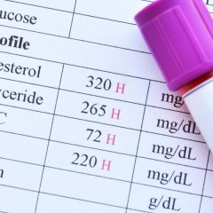 Curso online de interpretación de resultados en bioquímica clínica para Técnicos de Laboratorio