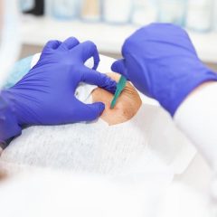 Técnicas y Aplicaciones Clínicas para el Técnico de Anatomía Patológica y Citodiagnóstico