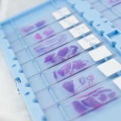 lesiones citológicas e histológicas